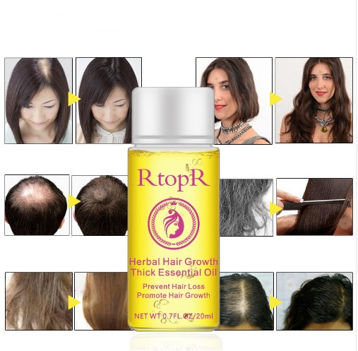 RtopR Herbal Hair Growth Essential Oil – Thick & Healthy Hair
