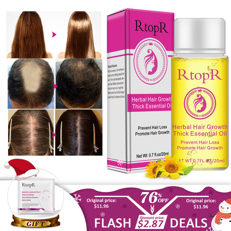 RtopR Herbal Hair Growth Essential Oil – Thick & Healthy Hair